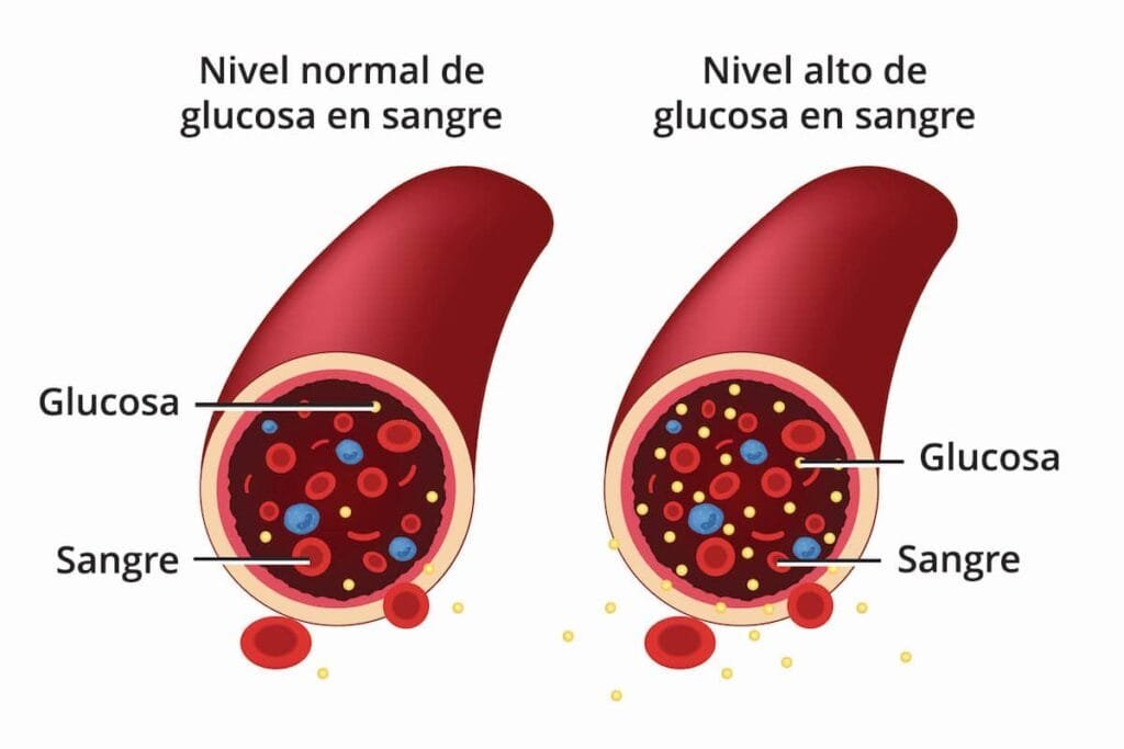 mala respuesta del cuerpo a la insulina
